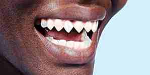 25 modifications corporelles surréalistes qui vous feront grincer des dents